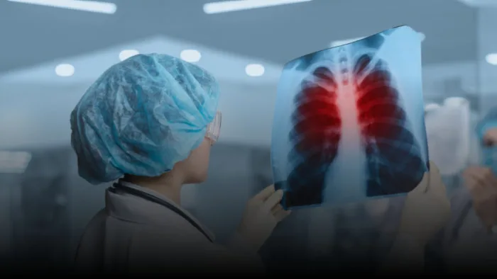 نوار قلب (EKG)